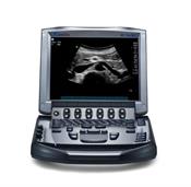 equipment-ultrasound-m-turbo.jpeg