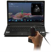 SonoSim Ultrasound Simulator