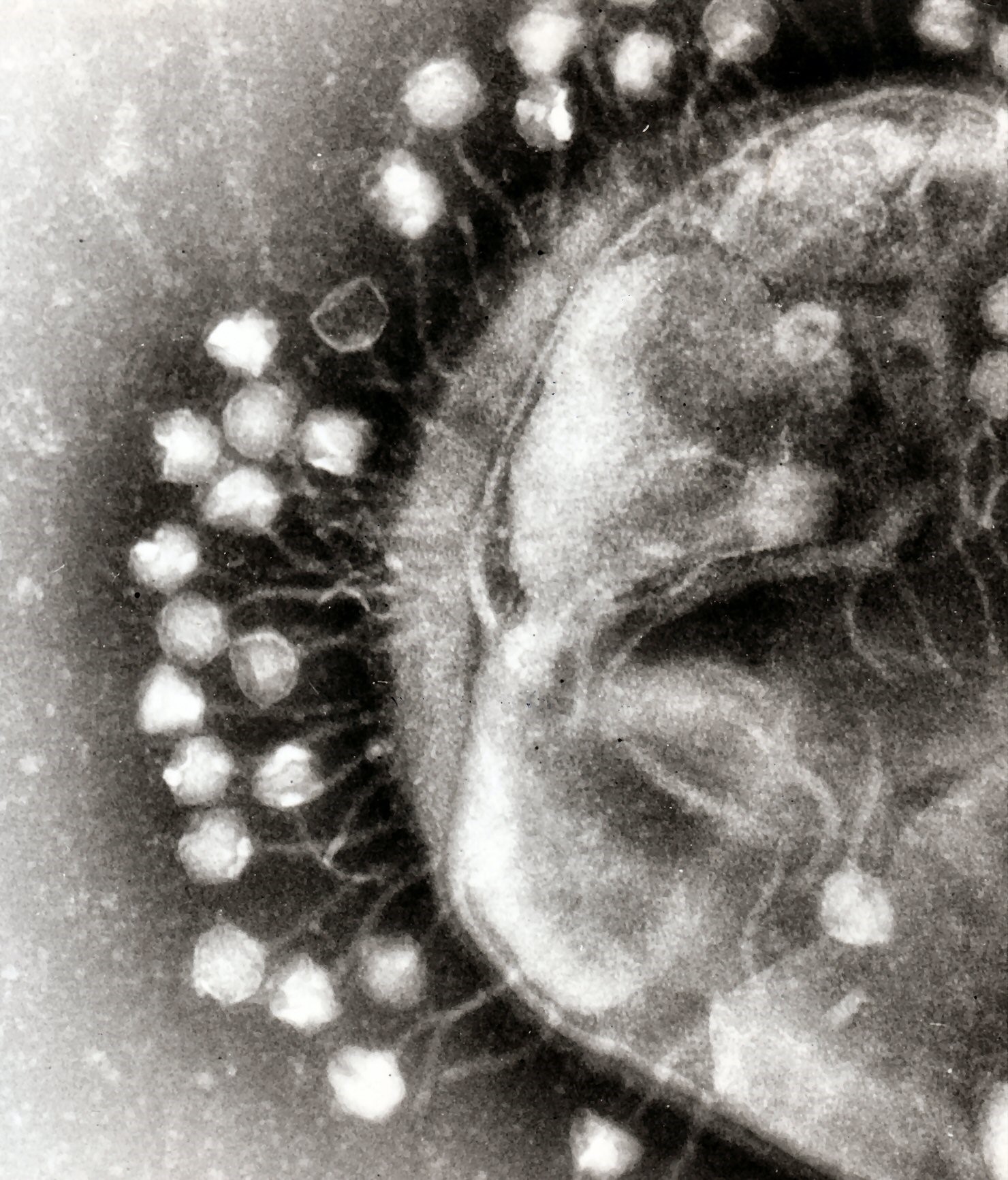 em of phages on bacterium
